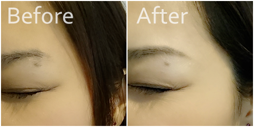 アナスタシア before & after